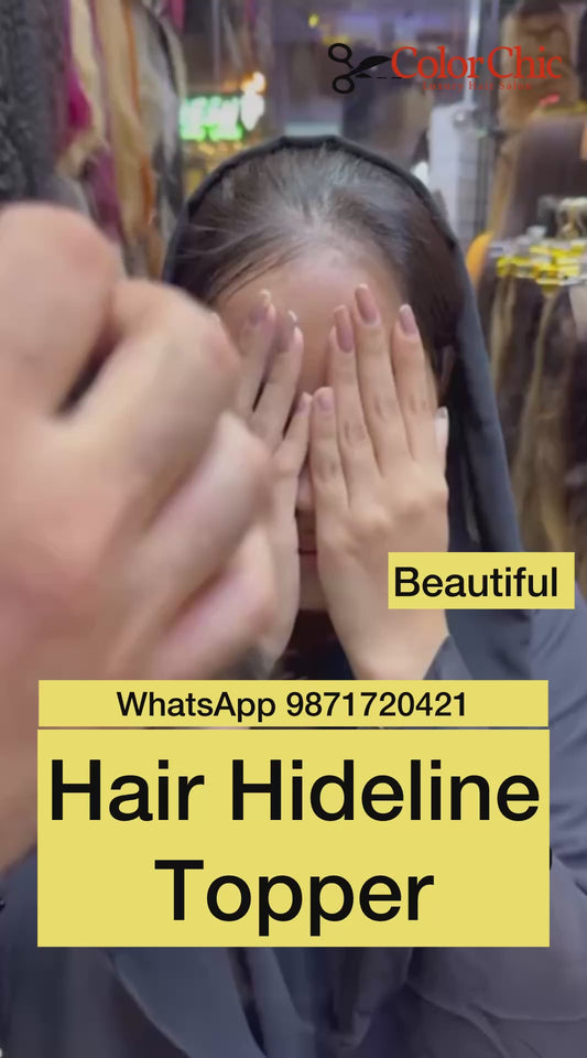 Hide Hairline